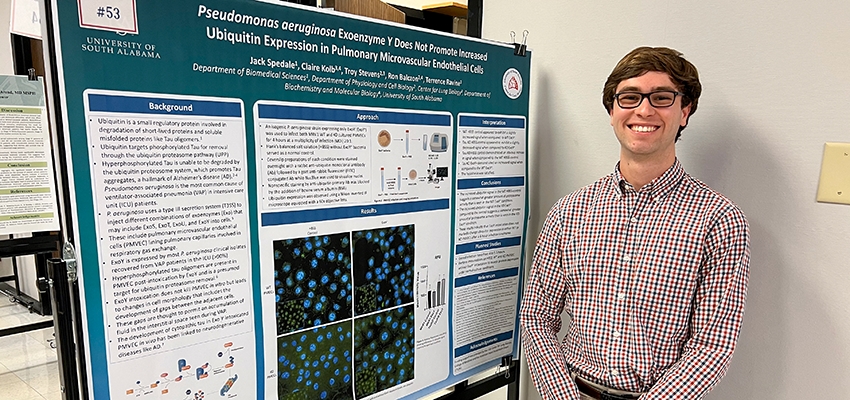 Biomedical Sciences Student Completes Summer Research on Respiratory Health